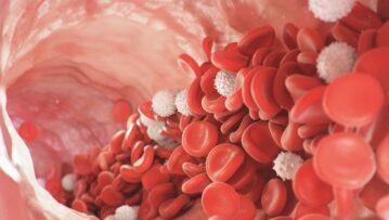 Prescient-Therapeutics-ASX-PTX-PTX-100-T-Cell-Lymphoma-white-blood-cell-cancer-study-phase-1B